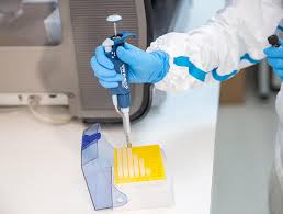 Din 74.000 de teste, 2% sunt pozitive. Testare Covid 19 Masurarea Performanta Cantitativa A Nivelului Anticorpilor Igg Anti Sars Cov 2 Reginamaria Ro