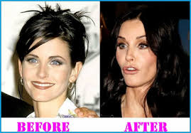 Erica durance, a canadian actress was listed among the celebrities who went under the knife too. Ohgxtmejbk8nom