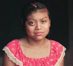 UCLA STEIN EYE INSTITUTE