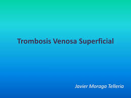 En un principio se puede ver que las venas varices aumentan de tamaño hasta convertirse en una especie de cordón duro al tacto. Ppt Trombosis Venosa Superficial Powerpoint Presentation Free Download Id 4612701