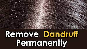 Other handy hair care tips to remove dandruff flakes: How To Remove Dandruff Permanently Quora