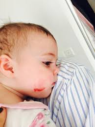 eloise sutton-kirkby is fundraising for DEBRA