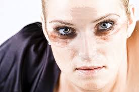 Borderline Personlichkeitsstorung Gesund Co At