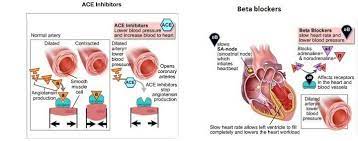 Effects Of Ace Inhibitors And Beta Blockers In Heart Failure Pathophysiology Nursing Pharmacology Nursing Paramedic School