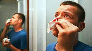 Blood when blowing nose cancer. Daily Nosebleeds Causes And Treatment