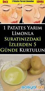 Maske Ciltmaskesi Bakim Ciltbakimi Yuzmaskesi Patateslimon Guzellik Healthy Skin Tips Skin Care Mask Natural Skin Care