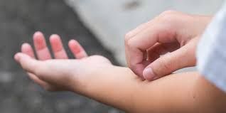 Check spelling or type a new query. 6 Kemungkinan Penyebab Kulit Tiba Tiba Gatal Dari Alergi Sampai Leukemia