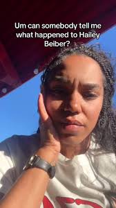 Hailey Bieber Cosa È Successo