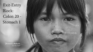 I retired as an acupuncturist