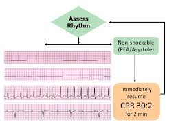 Epub ahead of print:.pubmed • full text • pdf • clinicaltrials.gov. In Hospital Resuscitation And Defibrillation Ppt Video Online Download