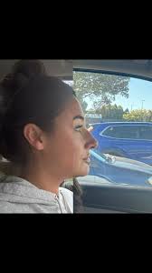 Look at this beautiful before & after 🥰, I used a combo of tox, filler,  Kybella, and Morpheus to create this gorgeous profile and harmonize her  features! , Can you guess where I put filler? If you’re ...