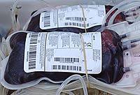 But that's not an indication of the color of the blood inside your veins. Venous Blood Wikipedia