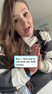 Healing Onycholysis: Nails Separating From Nail Bed Recovery Journey