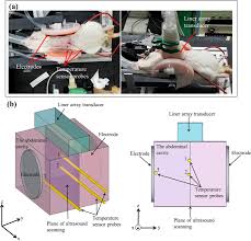 Such a device is often integrated as a component of a system that automatically performs a task or alerts a user of motion in an area. Temperature Elevation In Tissue Detected In Vivo Based On Statistical Analysis Of Ultrasonic Scattered Echoes Scientific Reports