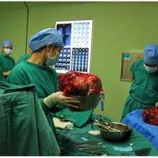 Tetapi, apa yang lebih mengejutkan apabila doktor menemukan seorang bayi di dalam perut wanita tersebut. 11 Kg Ketumbuhan Dalam Perut