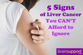 Cancer is one reason this organ may swell. 5 Signs Of Liver Cancer You Can T Afford To Ignore Liversupport Com