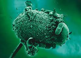 Cryptosporidium cryptosporidium muris oocysts found in human feces. Giardia And Cryptosporidium Diagnostics Techlab Inc