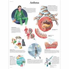 0% is black, 100% is white. Asthma Chart 1001354 3b Scientific Vr0328l Asthma Patient Education Asthma Models Asthma Charts And Posters Allergies Patient Education Allergies Charts And Posters