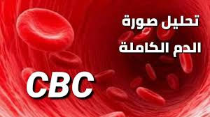 يطلب الطبيب من المريض إجراء فحص تعداد الدم الكامل أو صورة دم. ØªØ­Ù„ÙŠÙ„ Cbc ÙØ­Øµ ØªØ¹Ø¯Ø§Ø¯ Ø§Ù„Ø¯Ù…