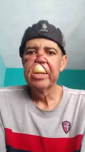 Avances en Radioterapia y Quimioterapia: Mensaje de Esperanza