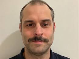 I was having huge problems with losing my hair