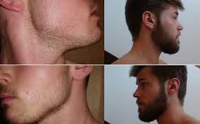 ابنة الاخ الاستمارة التحقق طريقة نمو اللحية allseasonsoutdoorkitchens com