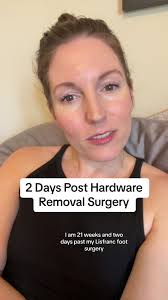 On that recovery train once again 💪 #lisfranc #footsurgery #footinjury  #lisfrancinjury #lisfrancrecovery #surgeryrecovery #hardwareremoval