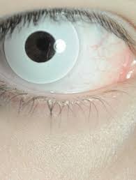 See Me White Eyes Eye Makeup Eye Contact