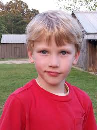 This Tuesday morning Dixon will undergo the first of three laser surgeries  at Children's Hospital. (The treatments are done two months apart.) This  will help promote healing and decrease the itching that