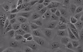 Formerly called cercopithecus aethiops, this group of monkeys has been split into several different species). Mdck Cell Lines Vero Cell Lines Esco Vaccixcell