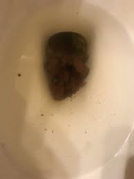 Provides suggestions for easing the symptoms of diarrhea in adults and children. Please Help Me I Am On The Brink Liquid Diarrhea For A Week And Feeling This Is The End Bowel Disorders Forums Patient