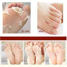 2 Packs Japanese Hyaluronic Acid Baby Feet Highly Effective Peeling Foot Mask By Jmart Shop Online For Beauty In Indonesia