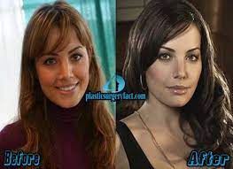 Erica durance plastic surgery may not be the first one among the actresses but based on her popularity it is quite a story. Erica Durance Plastic Surgery Before And After Pictures Plastic Surgery Facts