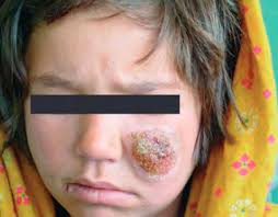 TESIS: EFECTO DE LOS AMASTIGOTES DE LEISHMANIA MEXICANA EN LA FAGOCITOSIS Y  PRODUCCIÓN DE CITOCINAS EN CÉLULAS DENDRÍTICAS MU