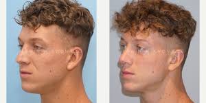 Edwin Kwon, MD, FACS, Board Certified Plastic Surgeon