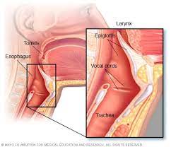 After suffering from esophageal cancer, patients will experience pain in the throat at an early stage. Throat Cancer Symptoms And Causes Mayo Clinic