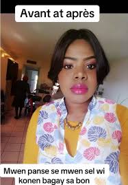 Beware of Fitness Trends: Apple Shape Insights