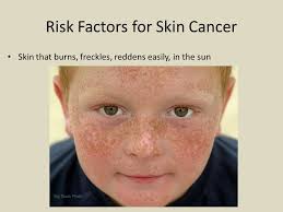 External icon you can work and play outside without raising your skin cancer risk by protecting your skin from the sun. May Is Skin Cancer Awareness Month Ppt Video Online Download