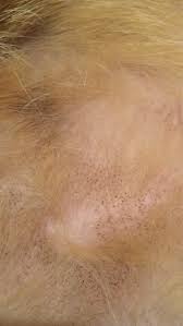 Black specks in urine caused diabetes, problems in the liver, infection in the urinary tract, stones in the bladder this is one of the reasons behind black specks in urine in males as well as females. Black Spots On Skin Cat Forum