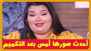 أحدث صور لـ ندى رحمى أمس بعد عملية التكميم وشاهد زوجها وشقيقتها ومعا نا تها بعد طلاق و الديها Youtube