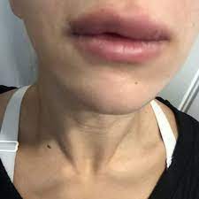 So helpful and go out of their way to . Aesthetic Medical Educators Training Educational Services 320 N Main St Buda Tx Phone Number Yelp