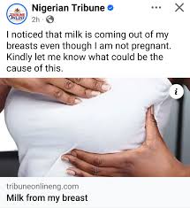 Image result for Galactorrhea