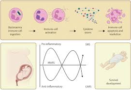 Image result for Neonatal Sepsis