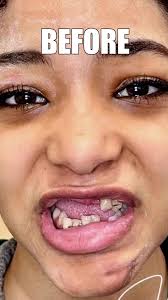 I will be showing this incredible cosmetic makeover I completed with Dr.  John Vargas in NY this Thursday