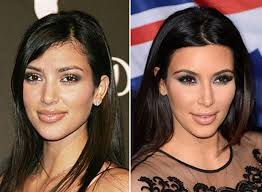 Top 10 Best Celebrity Nose Jobs Featuring Kim Kardashian Ashley Tisdale Blake Lively D Kim Kardashian Short Hair Kim Kardashian Before Kim Kardashian Makeup