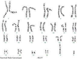 Karyotyping An Overview Sciencedirect Topics