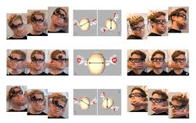 Image result for Horizontal Head Impulse Test