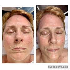 Project Face Memphis