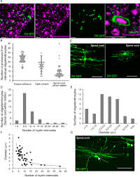 The ic8 is designed with all levels of cyclists in mind, and thus has 100 different resistance levels available. Rabies Virus Mediated Oligodendrocyte Labeling Reveals A Single Oligodendrocyte Myelinates Axons From Distinct Brain Regions Osanai 2017 Glia Wiley Online Library