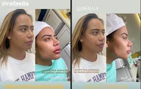 O filho mais velho da cantora walkyria usou sua rede social para desabafar sobre a morte prematura de seu irmão caçula, lucas santos, de 16 anos. Rafaella Santos Faz Antes E Depois De Remodelacao Facial Fofocas E Famosos